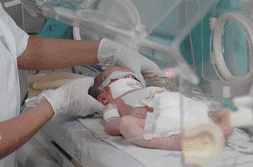 Mortalidade infantil nos pases pobres tem forte reduo