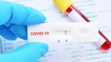 Osvaldo Cruz confirma mais 26 novos casos positivos de Covid-19